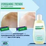 Hydroquinone 2 ounce